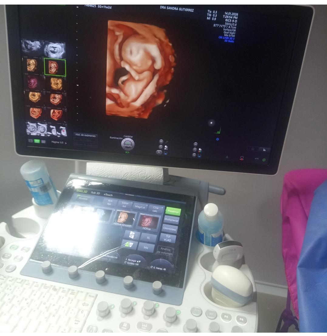 Equipos de última tecnología — Embarazo al Día Bogotá